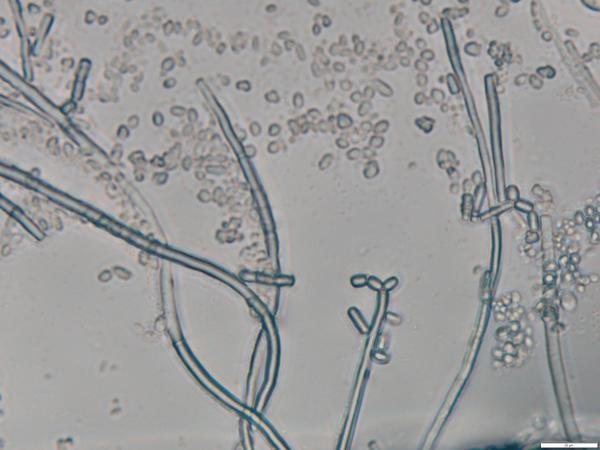 Thumbnail image for Geotrichum Sour Rot of Sweetpotato