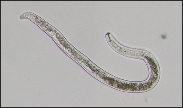 Thumbnail image for Lesion Nematode in Potato