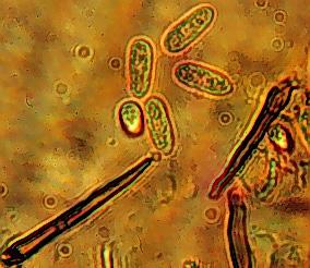 Thumbnail image for Anthracnose of Cucurbits