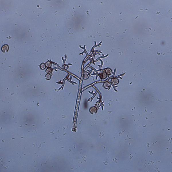Thumbnail image for Basil Downy Mildew